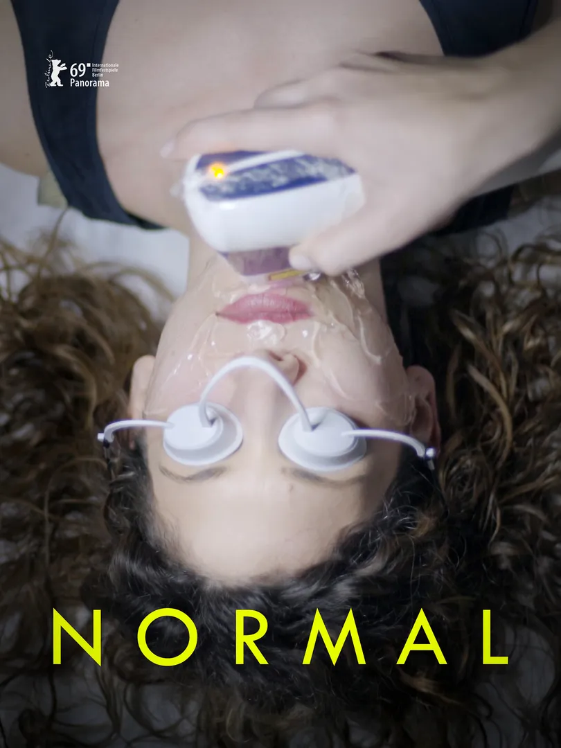 Normal
