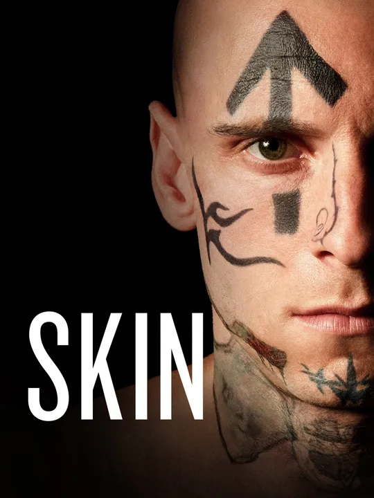 Skin
